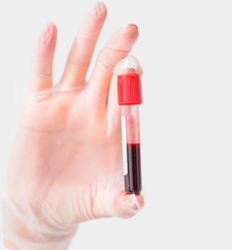 Why True Anti-Ageing Starts with Blood Testing